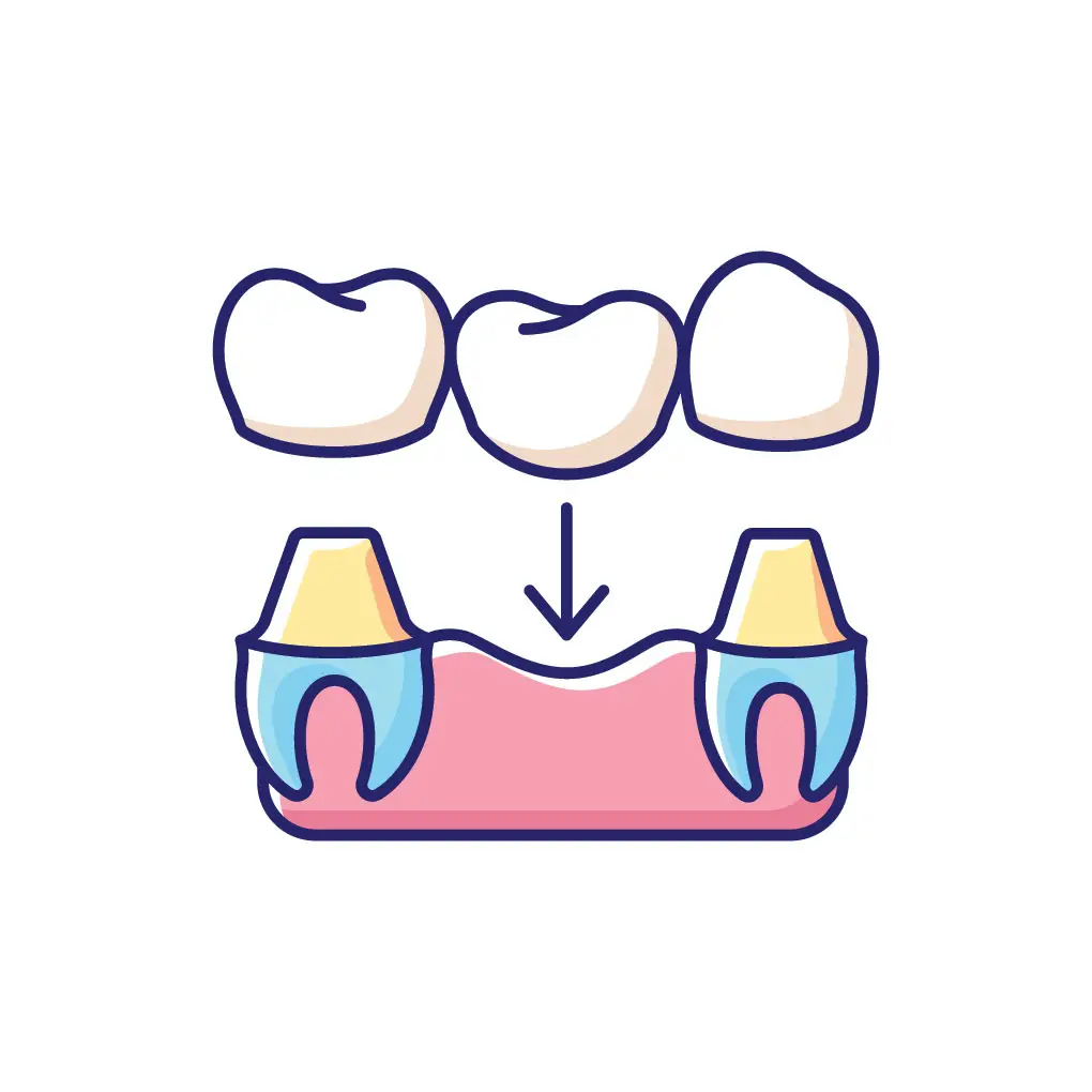 Dental Crowns Dental Crowns